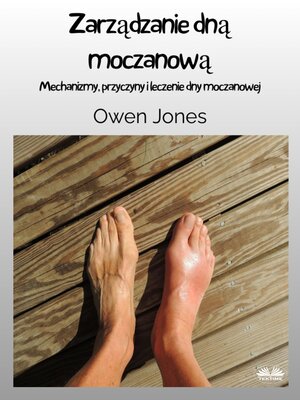 cover image of Zarządzanie Dną Moczanową